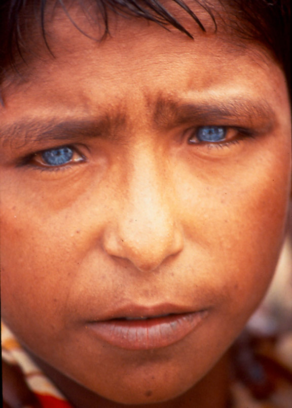     Steve Fenech, Little Boy in Bangladesh, 1992
